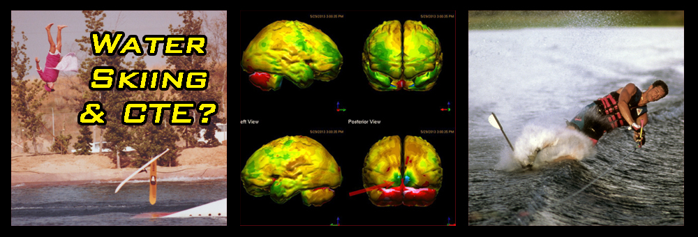 cte and water skiing chronic traumatic encephalopathy